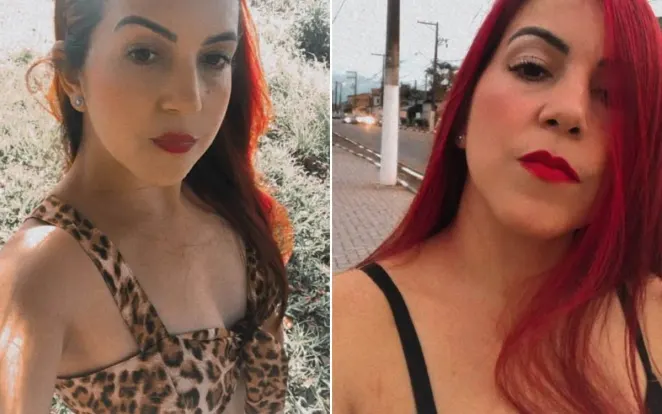 Quem era a mulher que morreu após cirurgia plástica em SP
